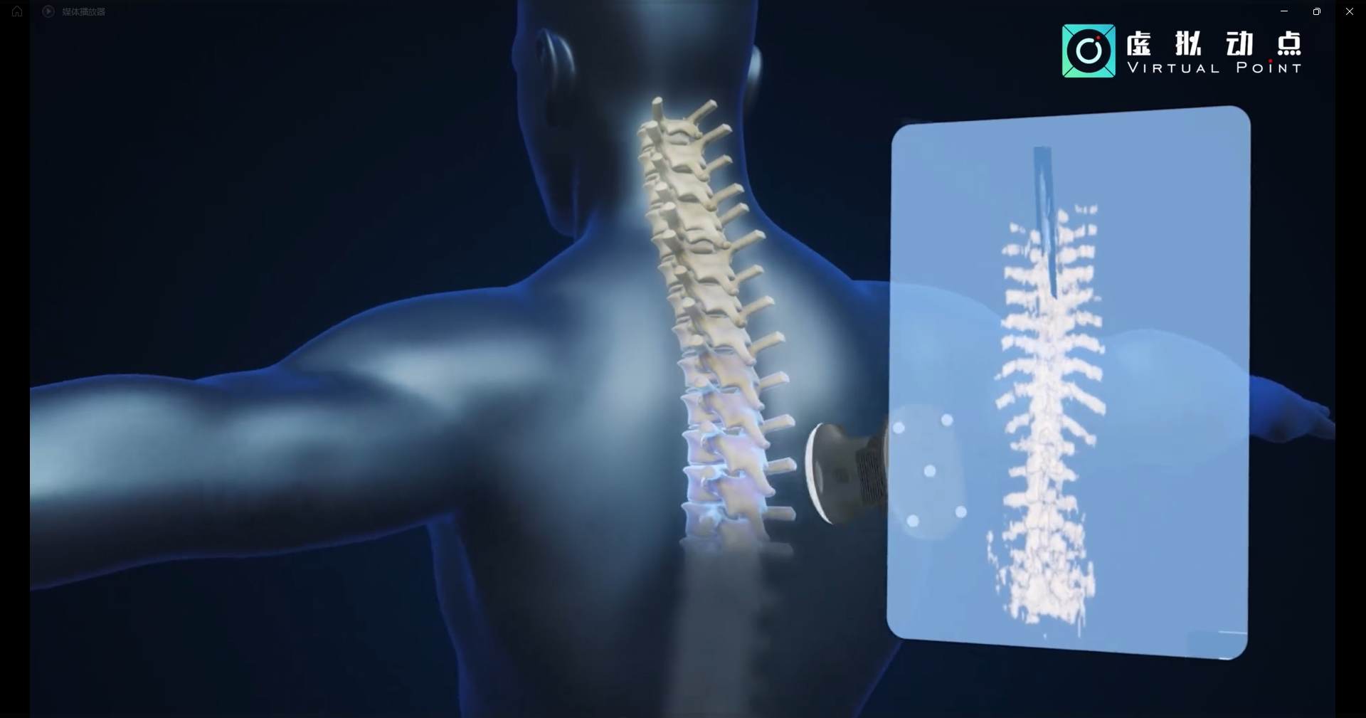 K8凯发·虚拟动点OptiTrack开创3D超声成像在脊柱诊断中的应用